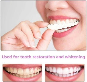Artificial Teeth Veneers