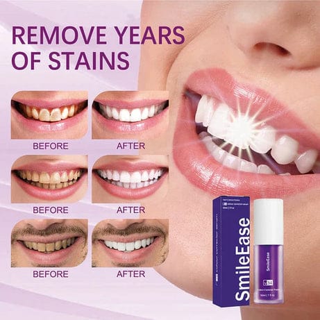 Teeth Whitener