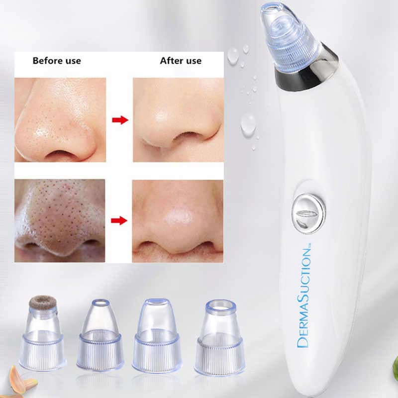 Pore Vacuum Cleaner